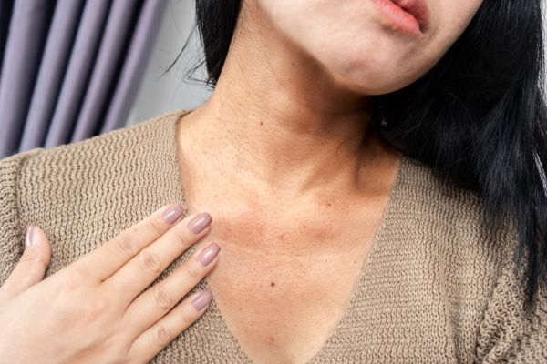 zmarszczki przy ustach