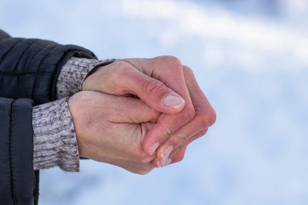 spierzchniete dlonie