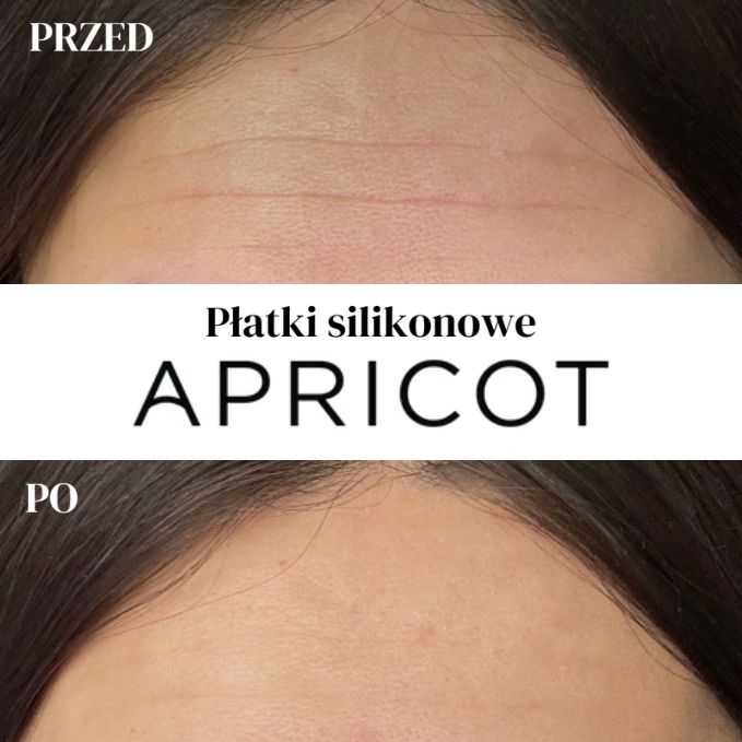 APRICOT