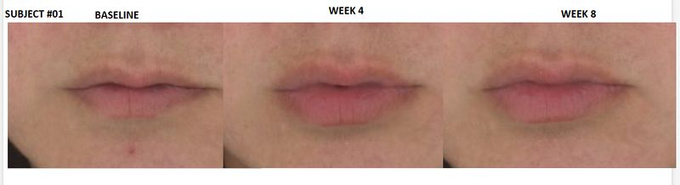 Double Fix For Lips™ Kuracja do ust 