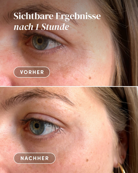 APRICOT wygładzające płatki pod oczy i na skronie "eye adore you"