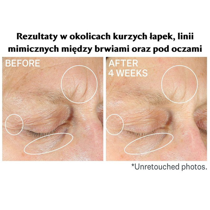 StriVectin Intensywny koncentrat przeciwzmarszczkowy pod oczy PLUS