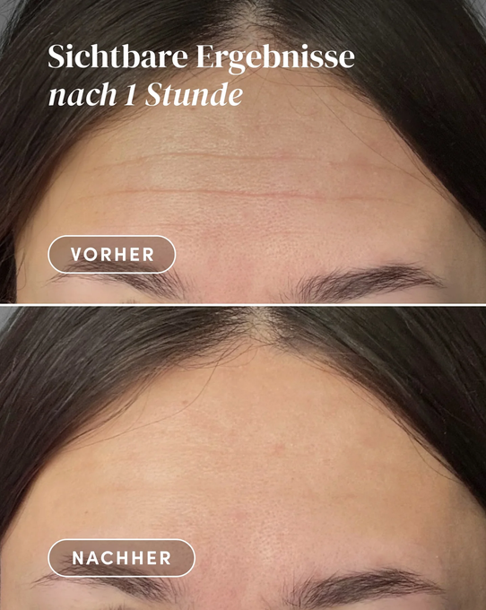 APRICOT wygładzająca maska na czoło "timeless you"