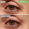 Serum pod oczy Retinol Youth Renewal Eye Serum