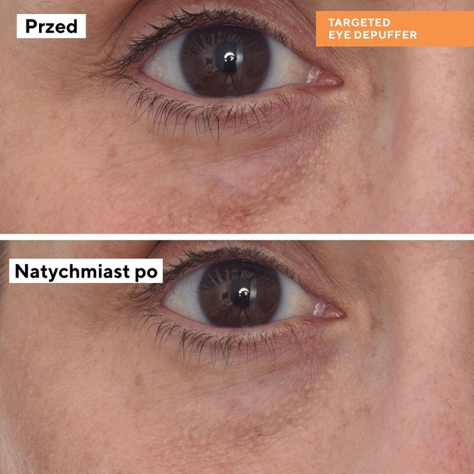 Murad Kuracja pod oczy Targeted Eye Depuffer
