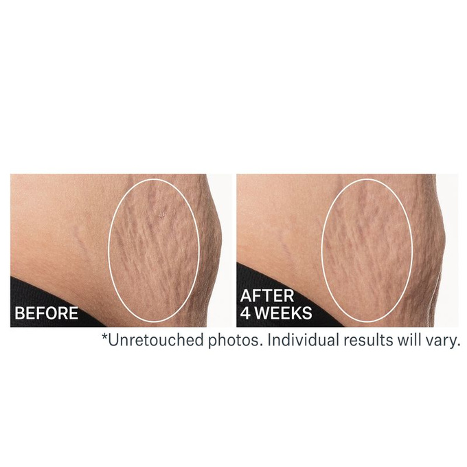 StriVectin SD Advanced Plus Krem na zmarszczki i rozstępy 118 ml