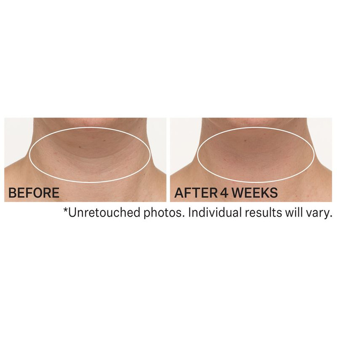 StriVectin TL Advanced Napinający krem na szyję i dekolt z peptydami 30 ml