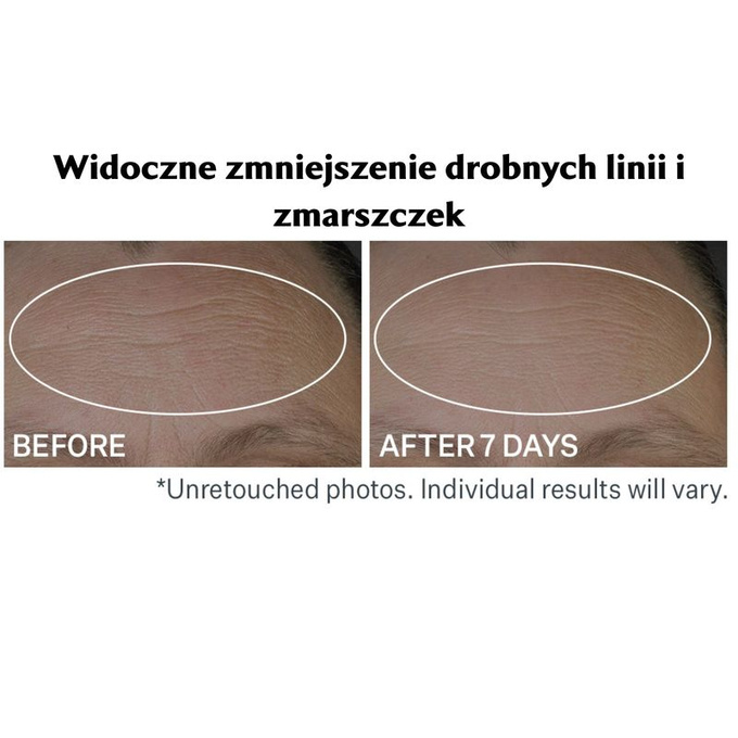 StriVectin Serum wypełniające zmarszczki i linie Peptide Plump™