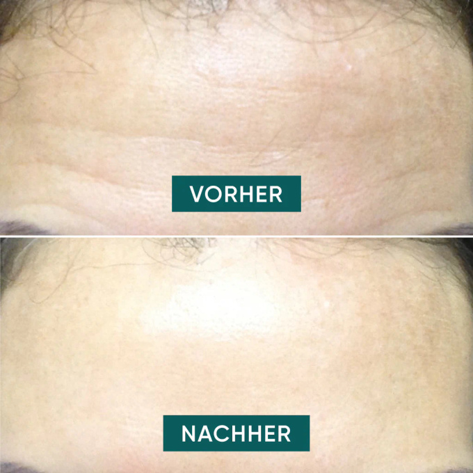 APRICOT wygładzająca maska na czoło "fantastic forehead"