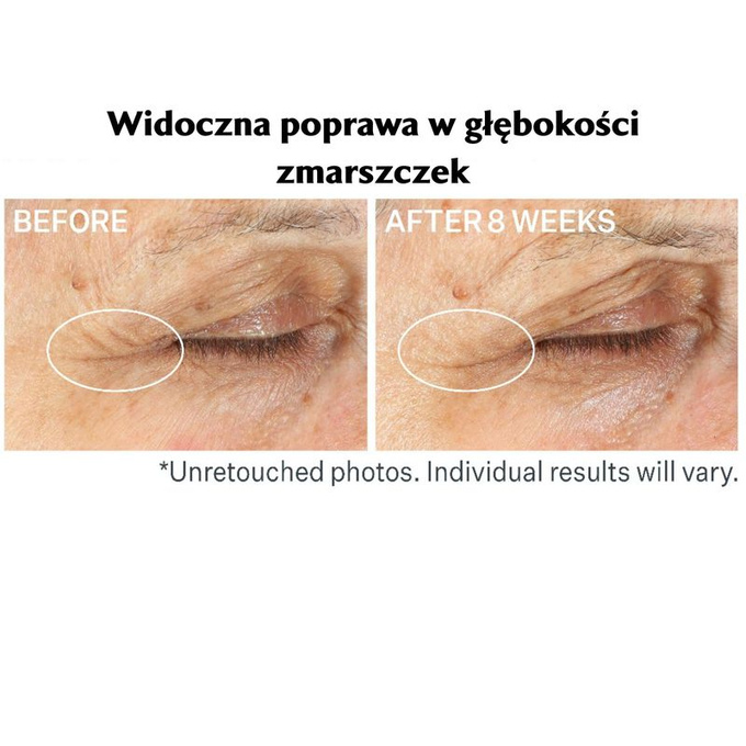 StriVectin Krem pod oczy z retinolem Advanced Retinol Multi-Correct 