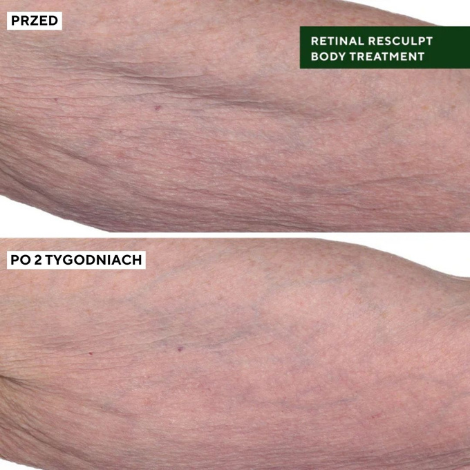 Murad Retinal Resculpt Body Treatment Ujędrniająca kuracja do ciała, 148 ml