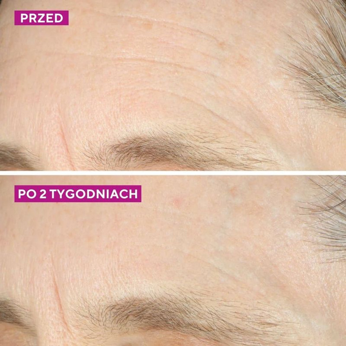 Murad Kojący krem nawilżający do twarzy i oczu Intense Recovery Cream