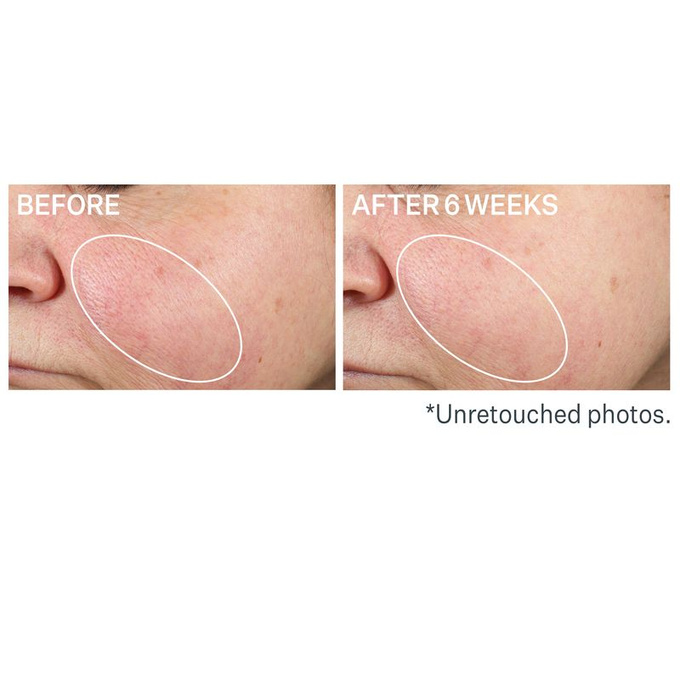 StriVectin Super-B Olejek wzmacniający barierę ochronną skóry