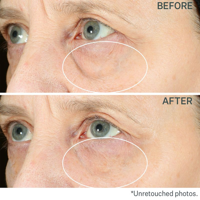 HYPERLIFT™ Natychmiastowa kuracja napinająca i liftingująca pod oczy