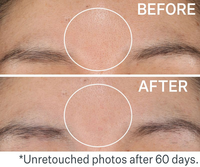 StriVectin Daily Reveal™ Płatki złuszczające