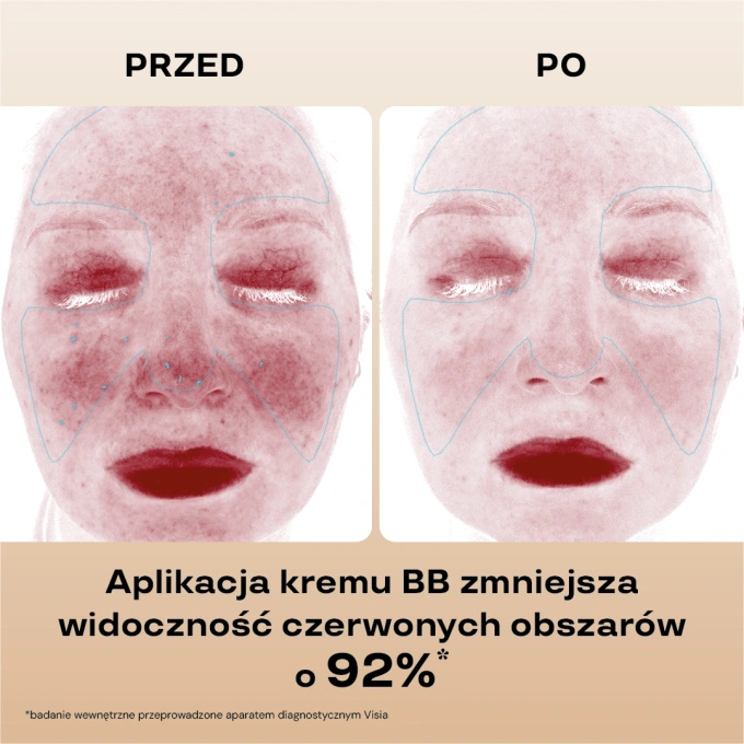 BasicLab Nawilżający krem BB SPF 15 – 210 Beige, 33 ml