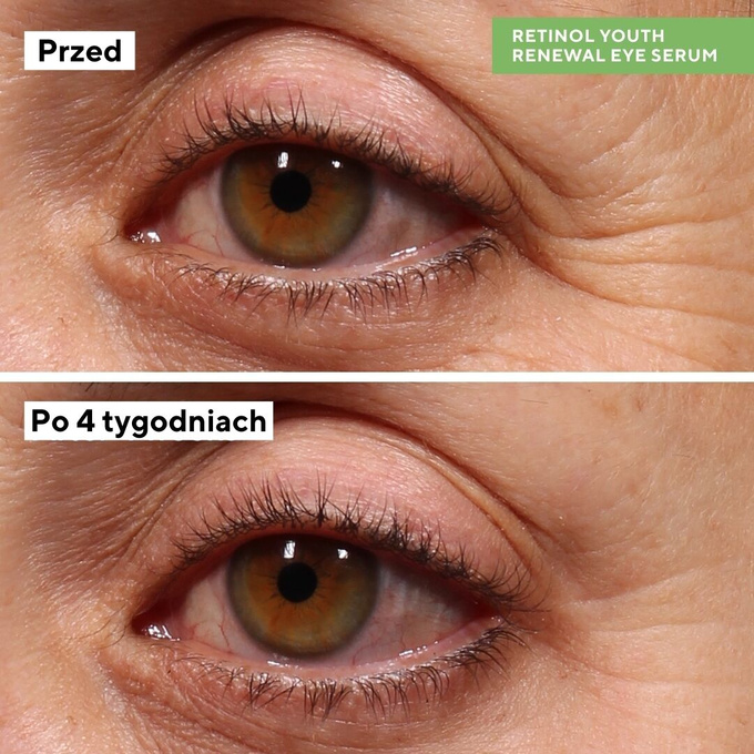 Serum pod oczy Retinol Youth Renewal Eye Serum