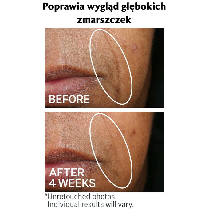 Wrinkle Recode™ Silnie nawilżający krem barierowy