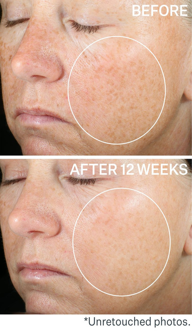 Super-C Rozświetlające serum z retinolem i witaminą C