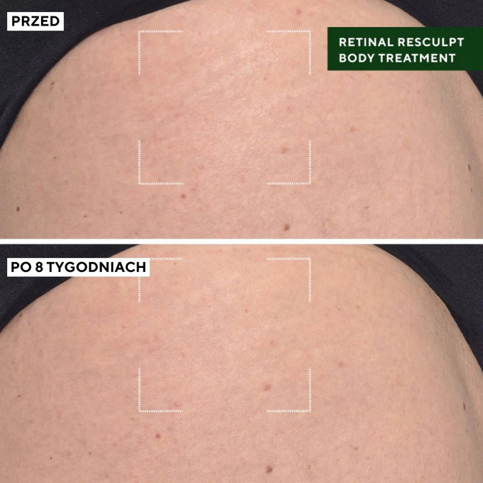 Murad Retinal Resculpt Body Treatment Ujędrniająca kuracja do ciała, 148 ml