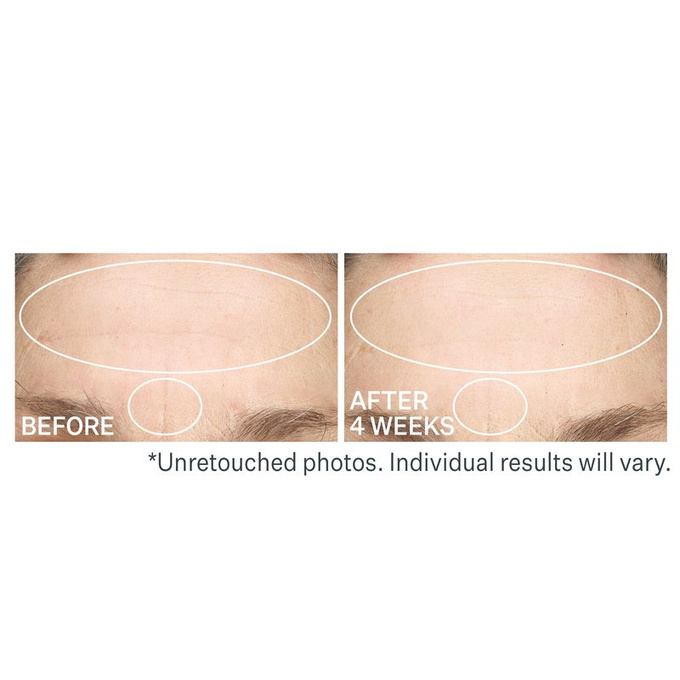 StriVectin SD Advanced Plus Krem na zmarszczki i rozstępy 60 ml