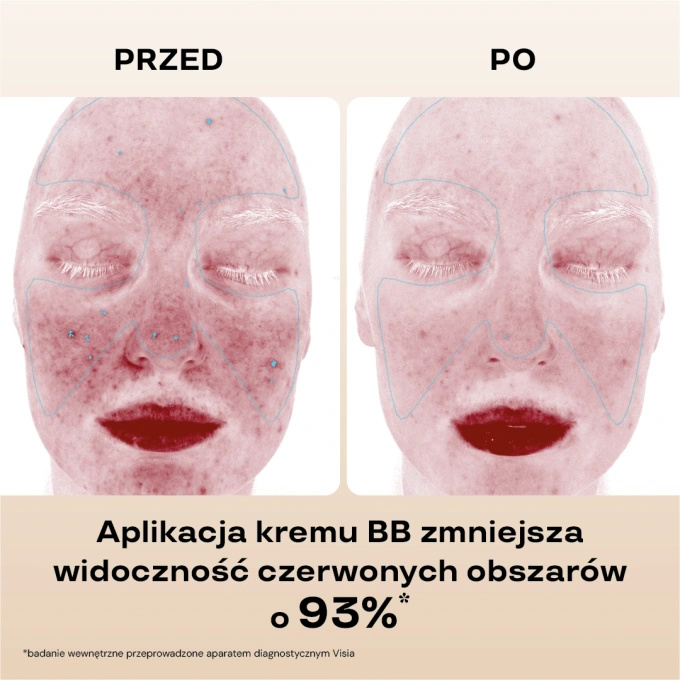 BasicLab Nawilżający krem BB SPF 15 – 110 Light, 33 ml