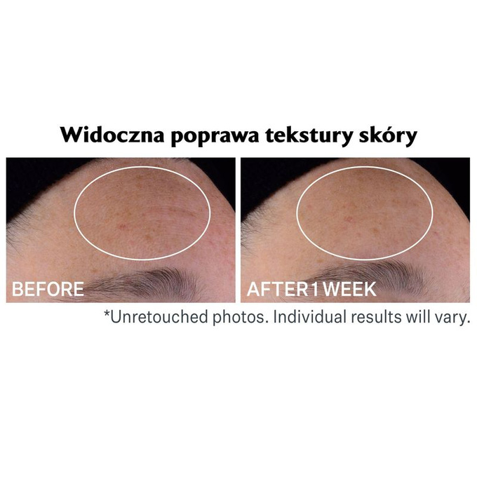 StriVectin Serum na noc z retinolem 30 ml