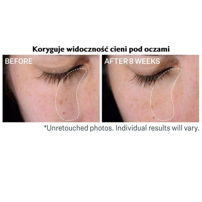 StriVectin Serum zmniejszające cienie pod oczami 15 ml