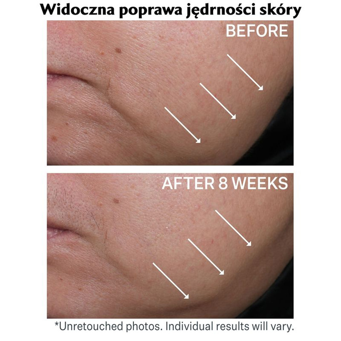 StriVectin Contour Restore napinająco-rzeźbiący krem to twarzy 50 ml