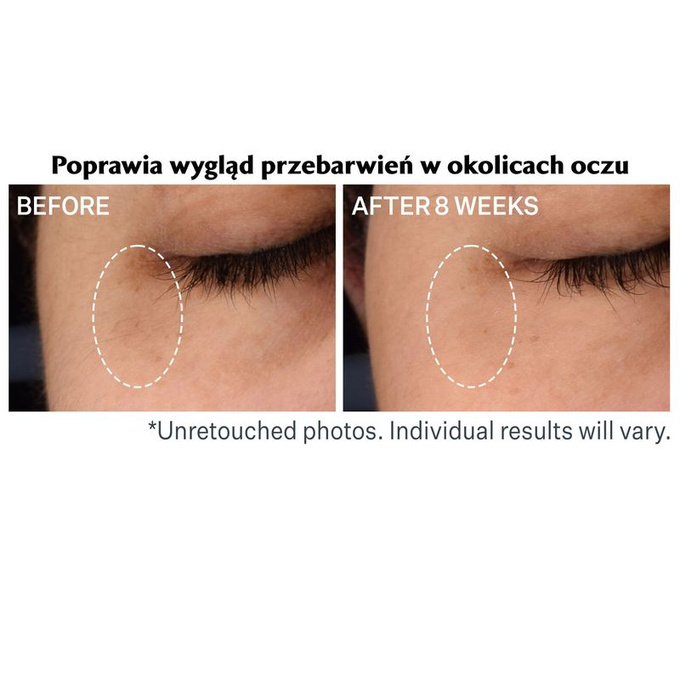 StriVectin Serum zmniejszające cienie pod oczami 15 ml