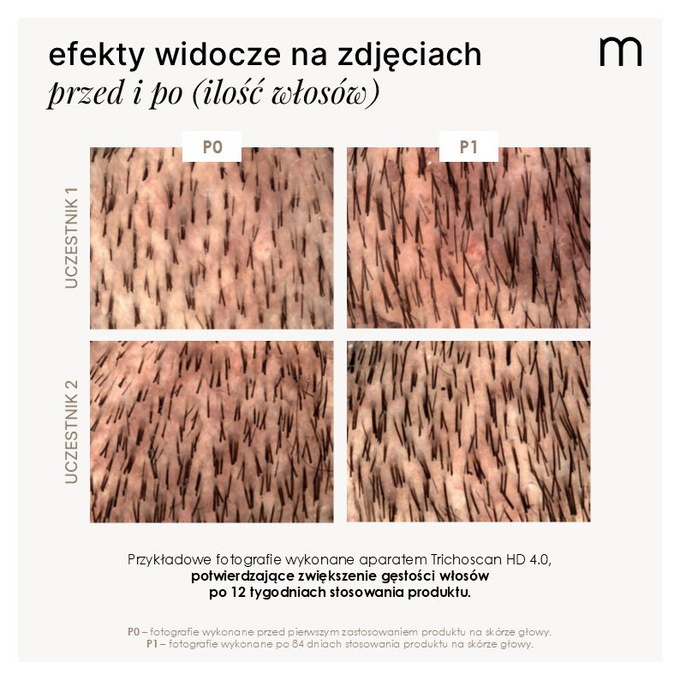 Mokosh Trychologiczne serum - wcierka stymulująca porost włosów, 90 ml
