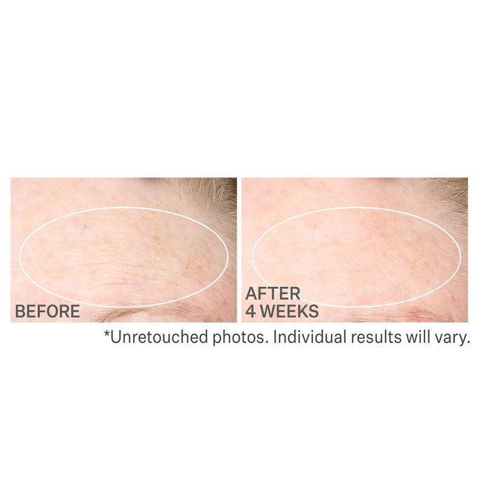 StriVectin SD Advanced Plus Krem na zmarszczki i rozstępy 118 ml