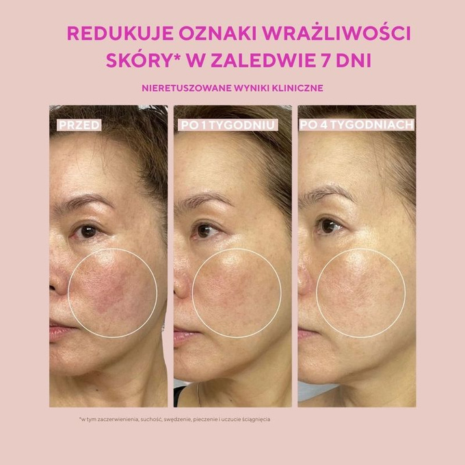 Murad Sensitive skin heartleaf gentle resurf serum - Delikatnie złuszczające serum, 30 ml