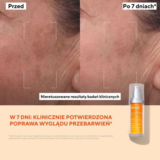 Murad Serum do twarzy Rapid Dark Spot Correcting Serum