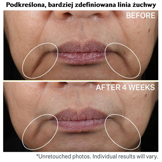 StriVectin Contour Restore napinająco-rzeźbiący krem to twarzy 50 ml