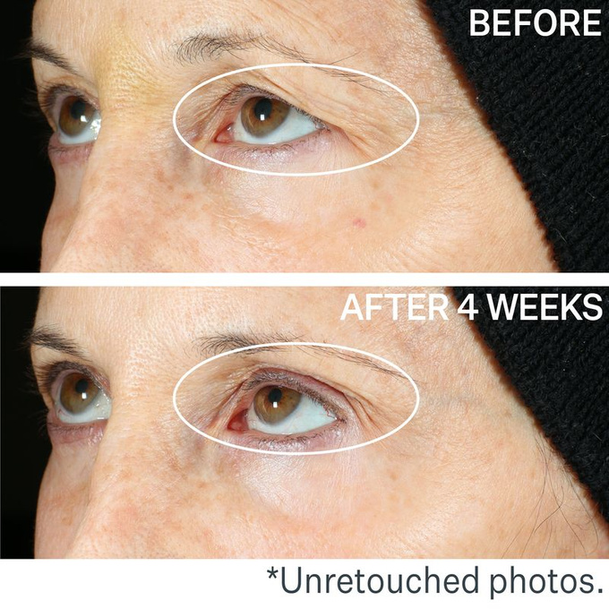 Peptight™ 360˚ Serum napinające i liftingujące pod oczy 