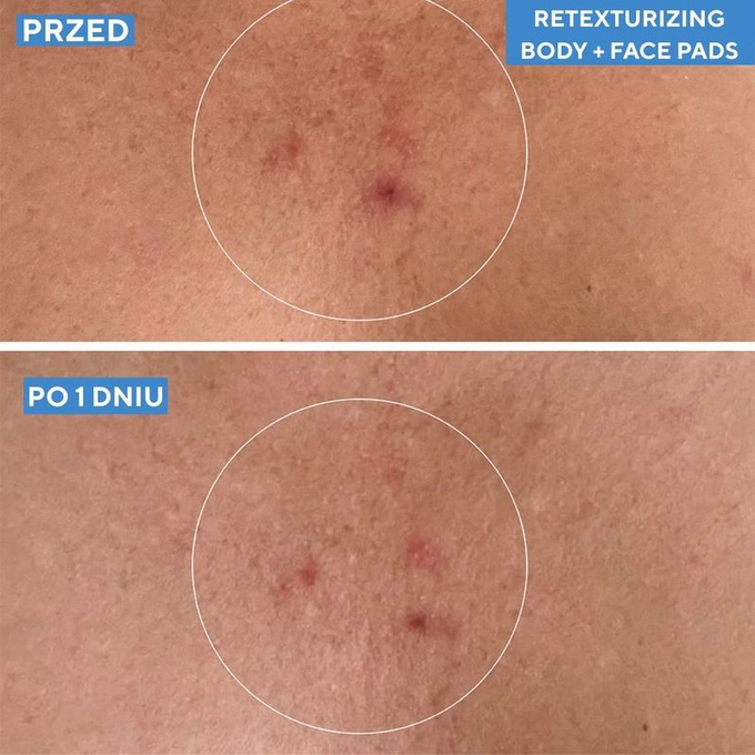 Murad Blemish Control Złuszczające płatki do ciała 45 szt | Puderikrem