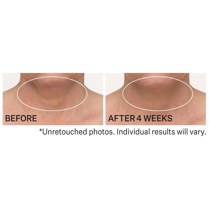 StriVectin TL Advanced Napinający krem na szyję i dekolt z peptydami 30 ml