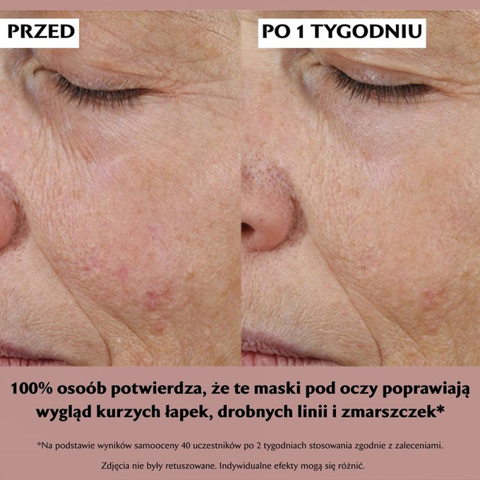 StriVectin Peptide Plump™ Kolagenowe płatki pod oczy, 6 par