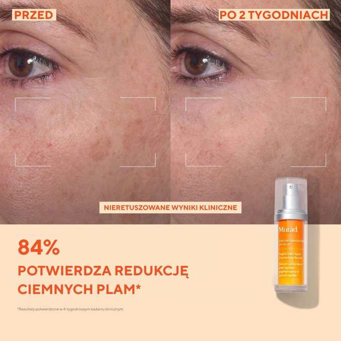 Murad Serum do twarzy Rapid Dark Spot Correcting Serum