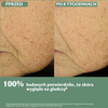 StriVectin Daily Reveal tonik wygładzający, 120 ml