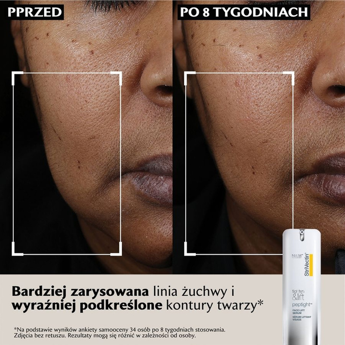 StriVectin Zestaw TL Serum + TL Neck cream