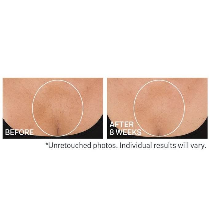 StriVectin TL Advanced Napinający krem na szyję i dekolt z peptydami 30 ml