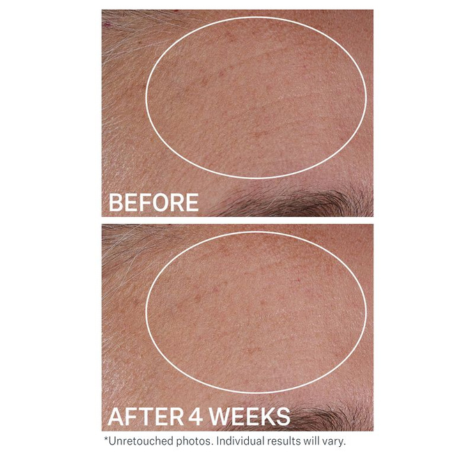 StriVectin Serum nawilżające z kwasem hialuronowym