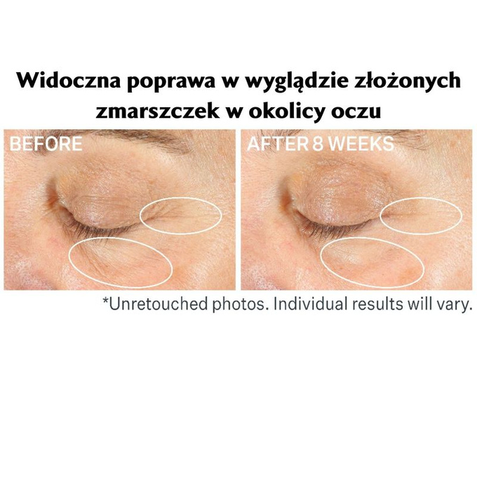 StriVectin Krem pod oczy z retinolem Advanced Retinol Multi-Correct 