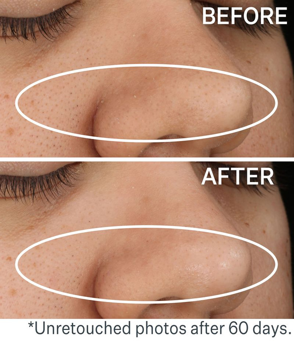 StriVectin Daily Reveal™ Płatki złuszczające