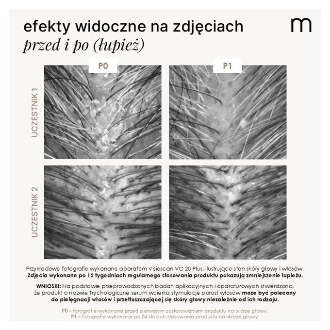 Mokosh Trychologiczne serum - wcierka stymulująca porost włosów, 90 ml