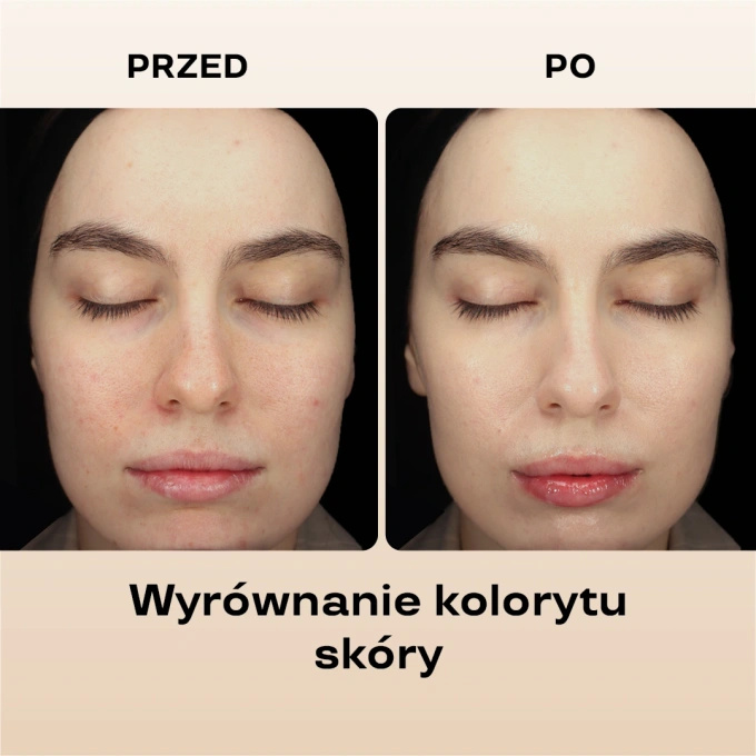 BasicLab Nawilżający krem BB SPF 15 – 110 Light, 33 ml