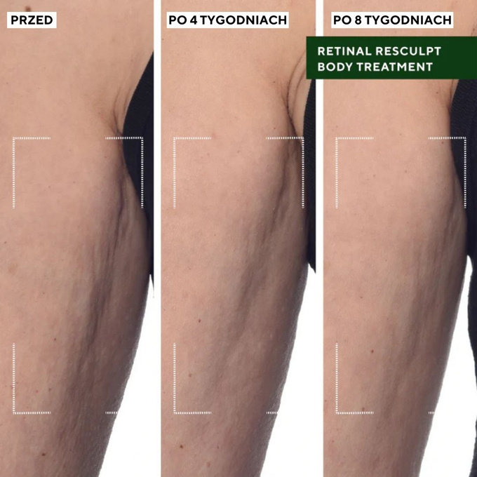 Murad Retinal Resculpt Body Treatment Ujędrniająca kuracja do ciała, 148 ml