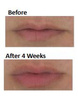 Double Fix For Lips™ Kuracja do ust 